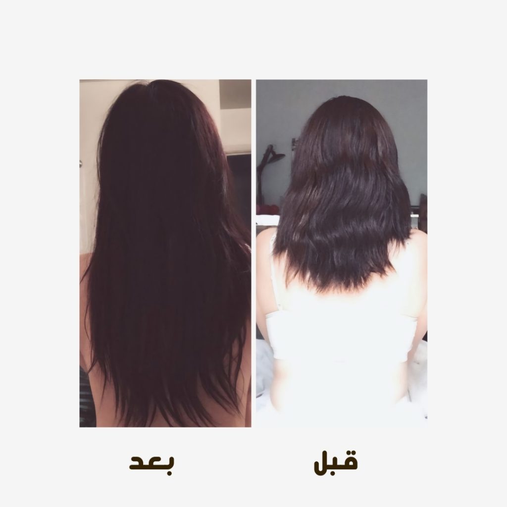 تساقط الشعر (6)