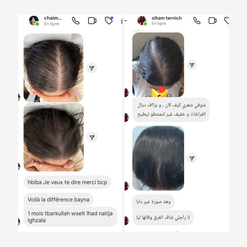 تساقط الشعر (7)