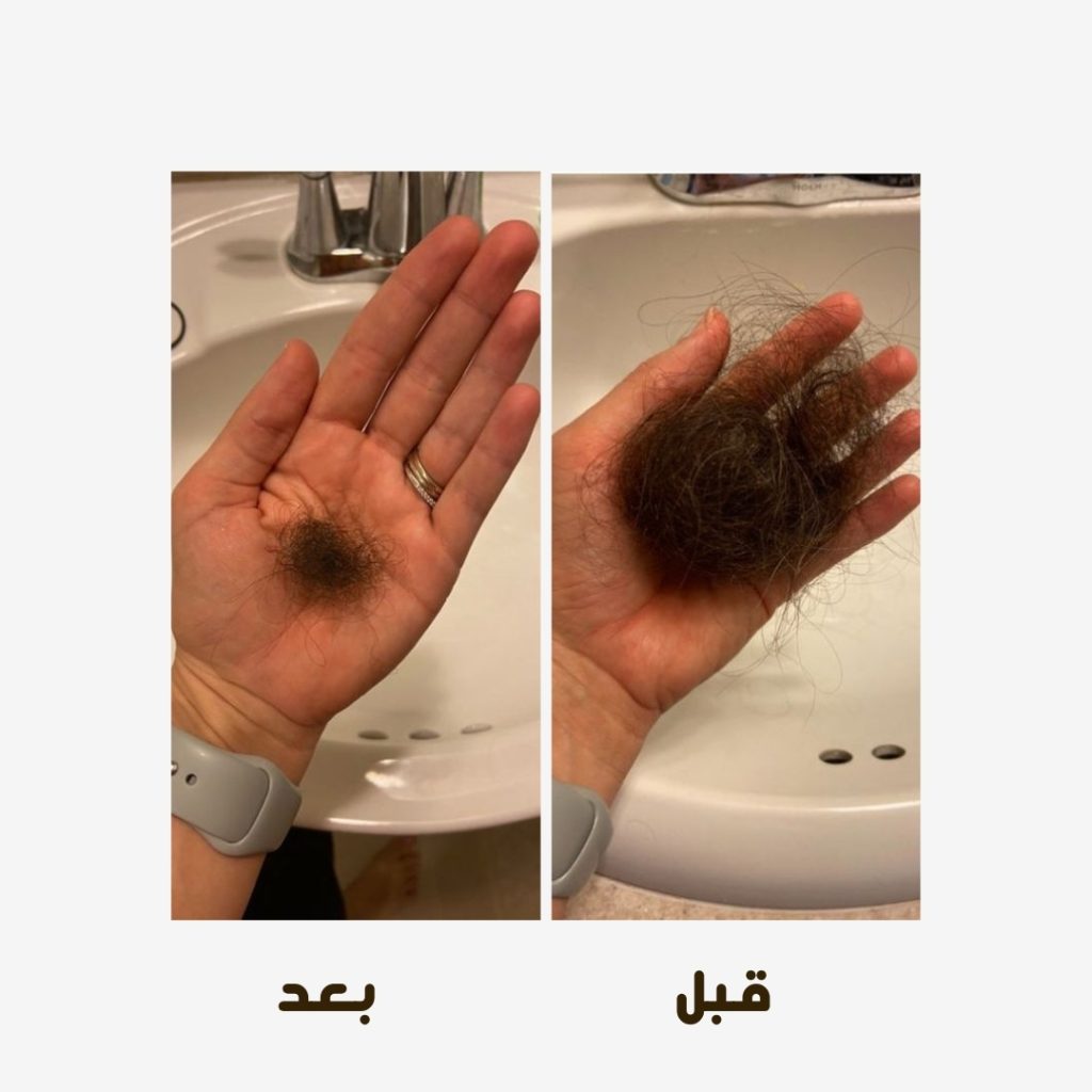 تساقط الشعر (9)