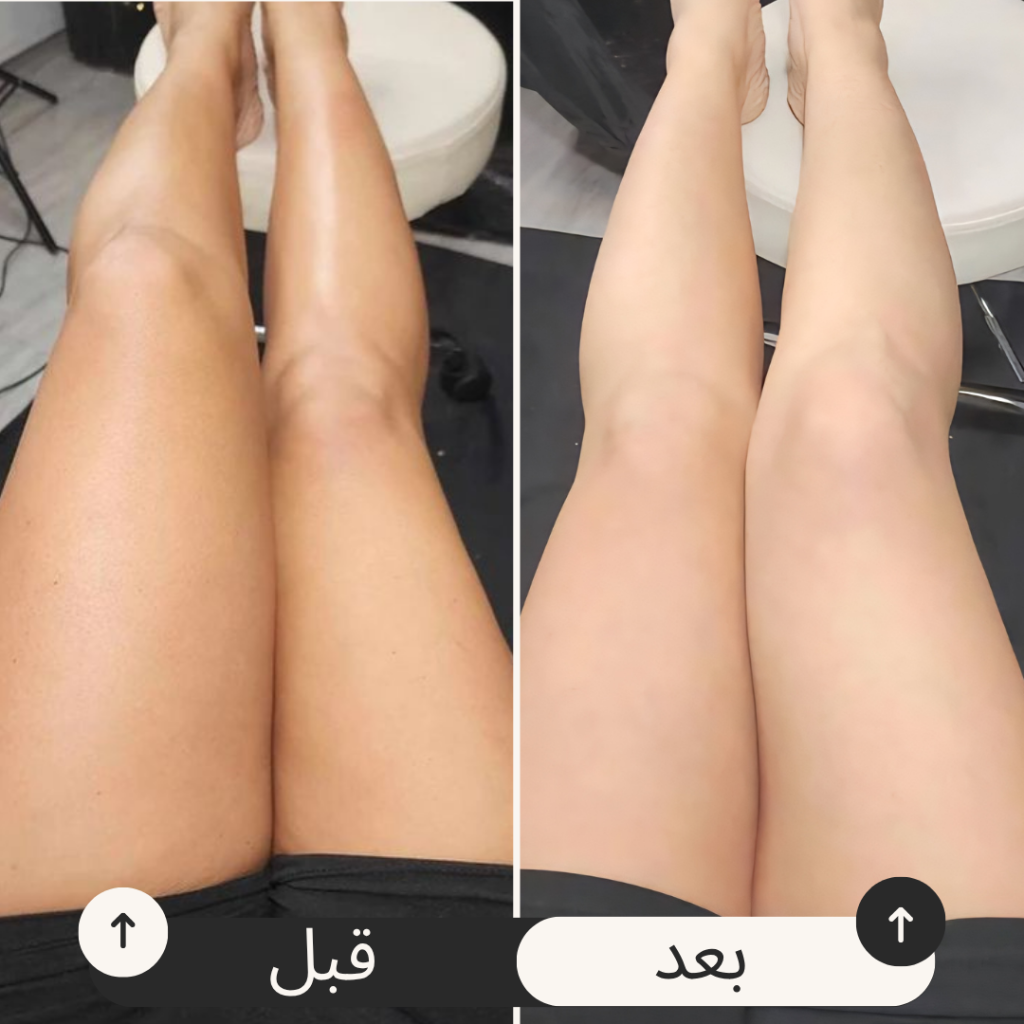 التصبغات
